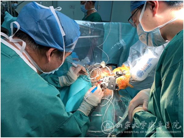 神经外科完成绿帽社首例手术机器人辅助脑深部电刺激器植入术